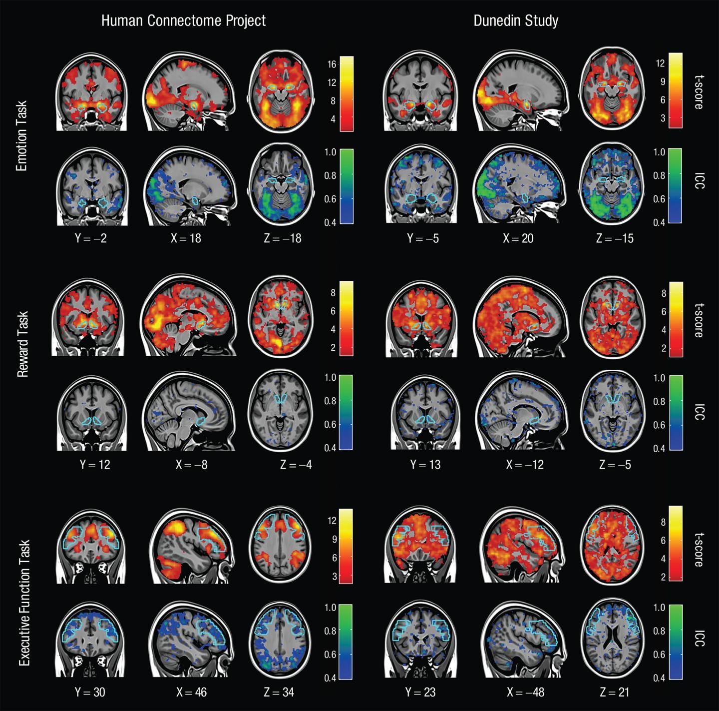 Real fMRI brain scans from the Human Connectome Project showing colorful activation maps across emotion, reward, and executive function tasks — the kind of seductive imagery that makes flawed methods harder to question